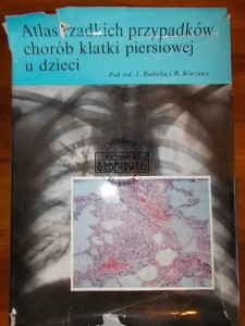 Atlas rzadkich przypadków chorób klatki piersiowej u dzieci