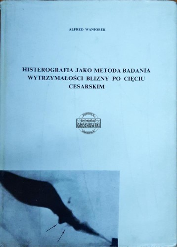 647731 Histerografia jako metoda badania wytrzymałości blizny po cięciu cesarskim