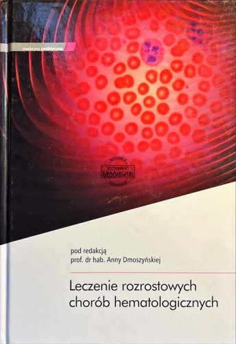 681430 Leczenie rozrostowych chorób hematologicznych