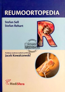 Reumoortopedia